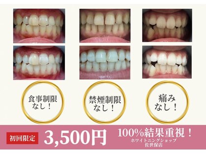 ホワイトニングショップ 佐世保店の写真