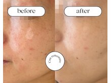 ユヌランコント 岐阜店(Une rencontre)/エンビロンのスペシャルケア