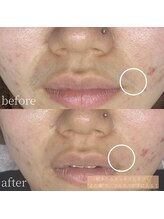 コモレビ(komorebi)/