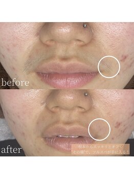 コモレビ(komorebi)/