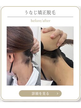 ミース 上野店/自然な美しさを実現