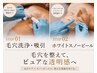 【毛穴・たるみ・シミケア】毛穴ケア×ホワイトスノーピールで艷めく小顔へ