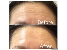 エムデコビューティ(M-DecoBeauty)の雰囲気（悩み別イオン導入で結果にこだわったエステだから人気です！）