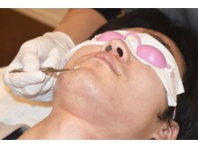 オアシスラグーン(OASIS LAGOON)/メンズ脱毛／ひげ脱毛