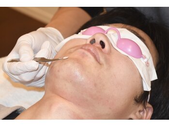 オアシスラグーン(OASIS LAGOON)/メンズ脱毛/ひげ脱毛