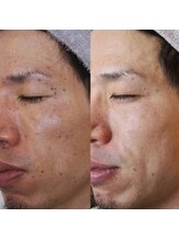 エトル(etole)/30代お客様症例写真