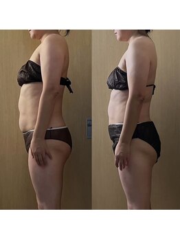 ココア(CoCoa)/活性リンパ洗浄