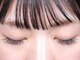 ロジウム(Rhodium)の写真