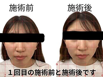 田端整体院/小顔整体/小顔矯正/伊勢崎/
