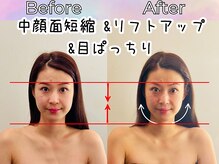 リストアハート(Restore Heart)