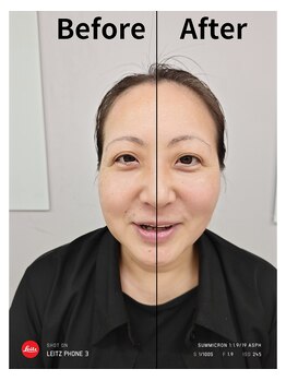 ジーサララ 用賀店(G.Sarara)/オイルマッサージ×小顔