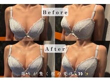 パフューム(Perfume)/