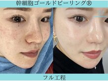 リメイク 広尾(REMAKE)/