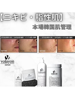 ナビ(NAVI)/【volayon】トリートメント