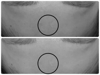 エフェクト 塚口店(effect)/Before After