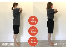 アイヴィー(IVY)/S様 ２ヶ月ビフォーアフター