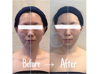 小顔フェイスラボ 瀬田店(小顔 Face Labo.)/小顔＆整体コルギの変化