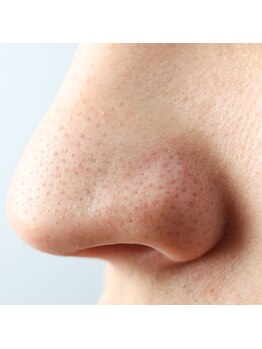 マヴィ 香里園店(MavY.)/プラズマの力で再生力を促す!