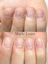 マリーロール 淀屋橋本店(Marie Laure)/自爪育成/深爪矯正/ネイルケア