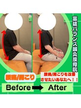 富雄バランス鍼灸接骨院/姿勢改善の方の施術後