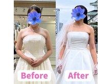 ボディキュア ブライダル美容整体 大阪梅田/【デコルテ】のもたつき解消！