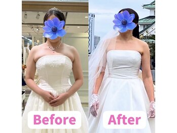 ボディキュア ブライダル美容整体 大阪梅田/【デコルテ】のもたつき解消!