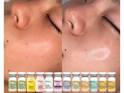 ヴィータ(VITA)の写真