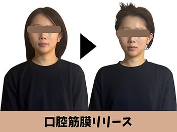 ミロク178式プロデュース(MIROKU178式プロデュース)/ブライダルエステとしても人気♪