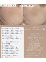 ルルボーテ(Loulou Beaute)/waxxxx＋VOSサロンケア