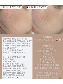 ルルボーテ(Loulou Beaute)/waxxxx+VOSサロンケア