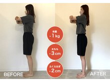 アイヴィー(IVY)/S様 4ヶ月ビフォーアフター