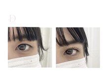 スウィートラッシュ 久喜テラレス店(Sweet Lash)/*Double eyelift*