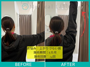 岐阜各務原整体院/肩コリでお悩みの方必見