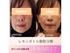 バリューネクスト 青葉台の写真