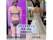 インプルーブ エステティック(Improve ESTHETIC)/