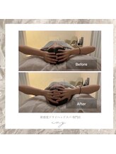 アイビー 恵比寿(ivy)/30代女性凝りからくる頭痛解消