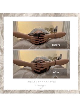 アイビー 恵比寿(ivy)/30代女性凝りからくる頭痛解消