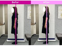 八女整体院/～肩こり改善～