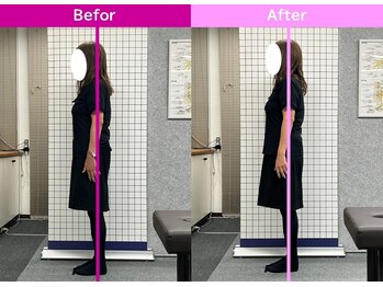 八女整体院/~肩こり改善~