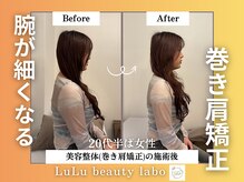 ルルラボ(LuLu beauty labo)/腕が細くなる巻き肩矯正！