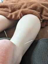 乃々鍼灸整体院 表参道/鍼灸×整体