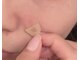 アンテリュール(Anterieur)の写真/新メニュー登場！シミがなくなれば若見え確定♪奥深くに蓄積したメラニンを自然に排出☆
