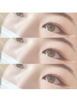 ロカヒ(Lokahi)/＊フラットマットラッシュ