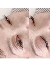 ブライド(Bride)/バインドロック