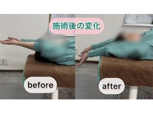 シオ 横浜関内(sio)/施術後の変化BeforeAfter