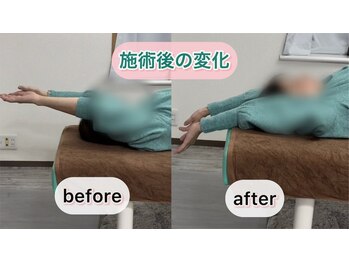 シオ 横浜関内(sio)/施術後の変化BeforeAfter
