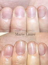 マリーロール 梅田店(Marie Laure)/自爪育成/深爪矯正/ネイルケア