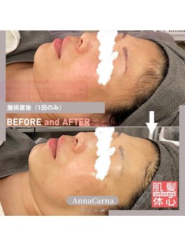 アンナカルナ(AnnaCarna)/透明感のあるノーファンデ肌へ