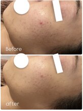 リノ(LINO)/様々なお悩みにアプローチ