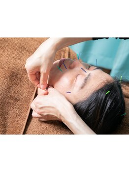 鍼灸施術を受けたい